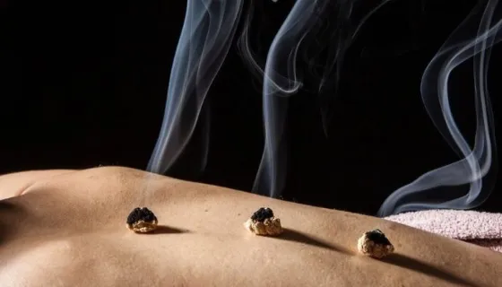 Moxibustion (艾灸)